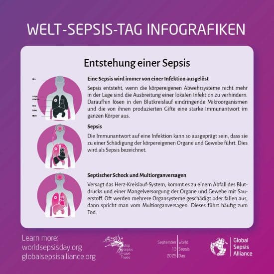 Beschreibung, wie eine Sepsis entstehen kann.